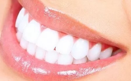 Laser Teeth Whitening for Tea and Coffee Stains