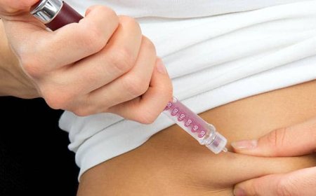 Wegovy and Hair Loss: Is There a Link?