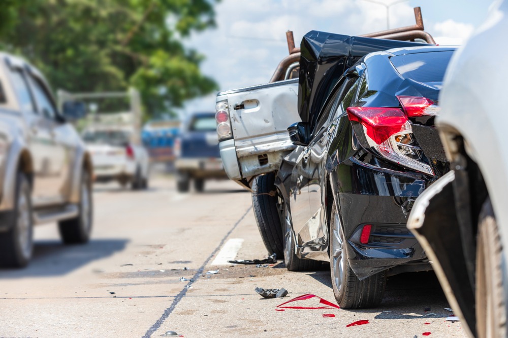 Who Can Benefit from a Car Accident Lawyer?Tampa